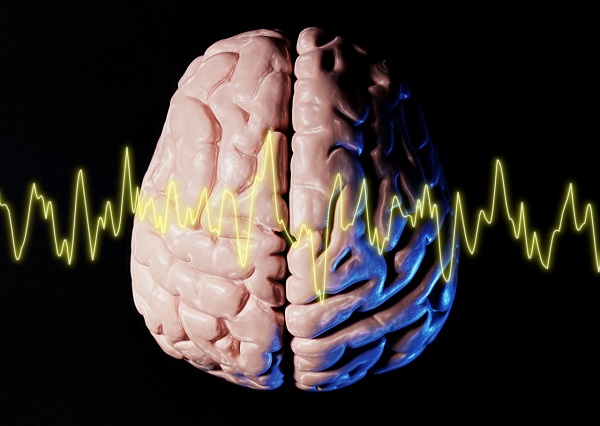 アルツハイマー型認知症予防に効果的なのは脳トレだけではない！